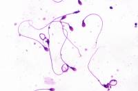Spermatozoïdes humains x 320